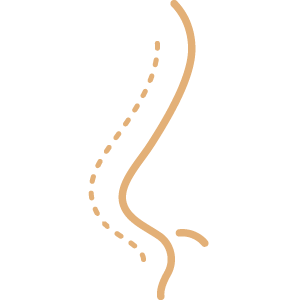 Hair Transplant 